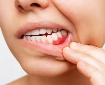 Periodontics Specialist at Robert Lawrence Wilson, DDS, P.A. in Heber Springs, Arkansas